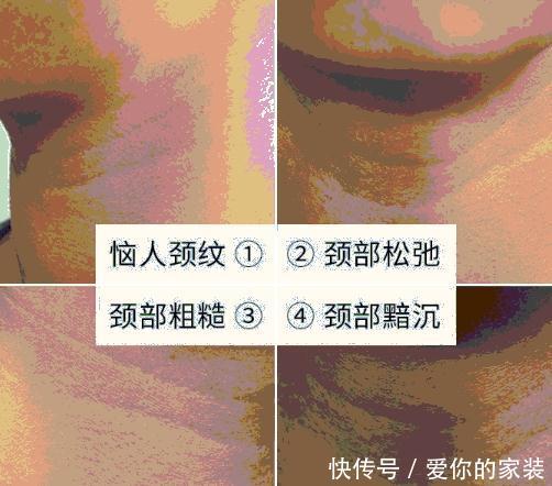 皮肤需要胶原蛋白