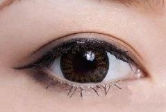  误区■八大处整形赵延勇：割双眼皮有哪些坑？