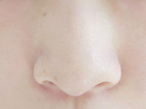 鼻子上布满黑头，分享四个去黑头技巧，让肌肤干净起来