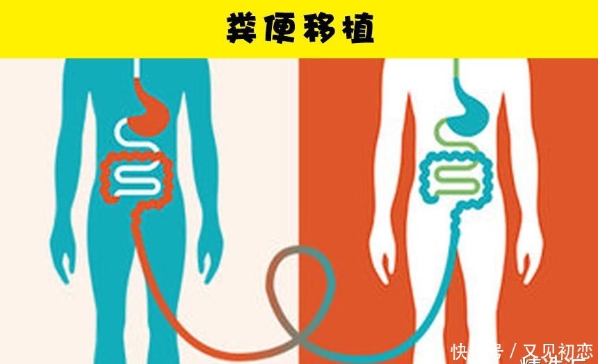  『鹦嘴鱼』关于便便，你所不知道的7个冷知识