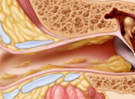 耳科主任泄密:耳屎别傻傻用手抠，用一个简单方法，耳屎全滚出来