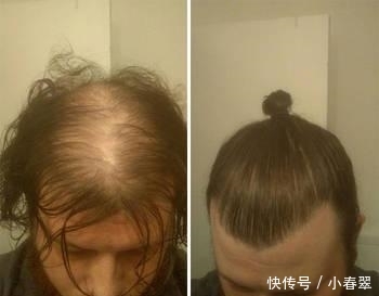  『人类』这真的是人类世界存在的发型？为了掩盖秃头我们有多努力！