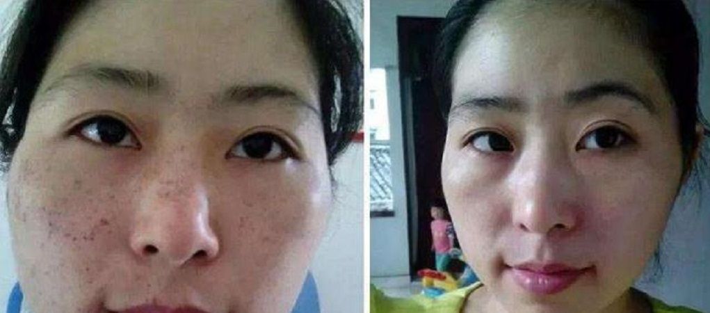  【脸上】白醋加它敷敷脸,坚持7天美白祛皱纹,肌肤白皙又光滑