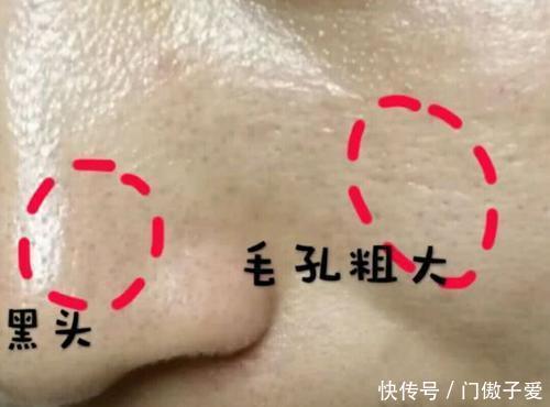  『可柏迷迭』毛孔粗大是衰老的开始，3个植物妙招收缩毛孔，让你瞬间年轻10岁