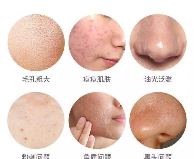 啃食:螨虫上脸疯狂产卵啃食皮肤,科学除螨需要这样做,别傻傻晒被子了