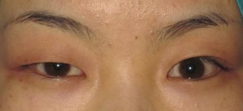 『好看』好看的单眼皮美到离谱！割双眼皮的意义在哪？
