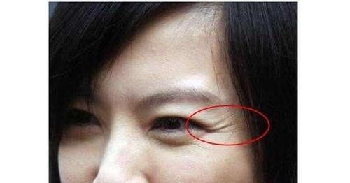  症状■肌肤变老有哪些症状?快来看看你的皮肤是否还年轻
