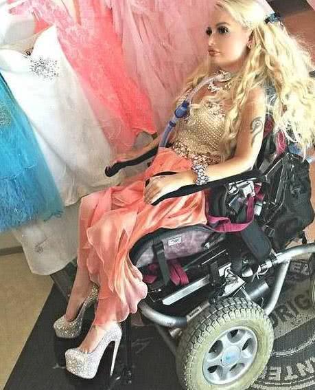 她四肢瘫痪仍坚持打扮成芭比娃娃的模样,如今成这样