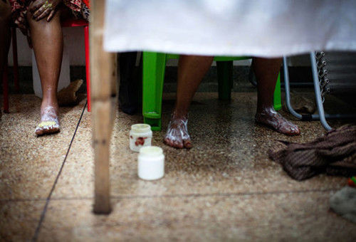 比整容还猛，非洲黑人少女流行把全身漂白