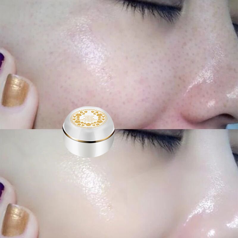 药店上班小姨说，这不起眼小乳膏，早晚涂一涂，淡化色斑更显年轻