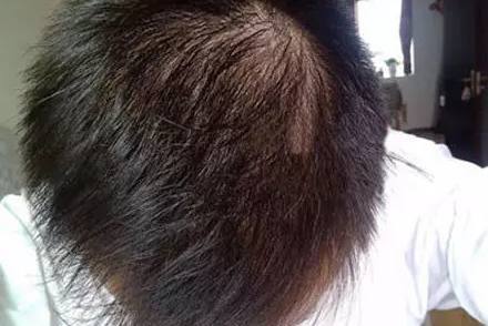 生活里常见的小苏打太多才多艺了，竟然还有如此神奇的好用处！