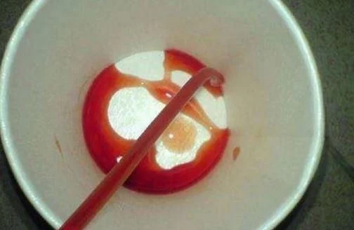 大小便时出现这几个症状,或是“癌症”的症状,发现就去医院检查 - 周公乐 - xinhua8848 的博客 大小便时出现这几个症状,或是“癌症”的症状,发现就去医院检查 - 周公乐 - xinhua8848 的博客