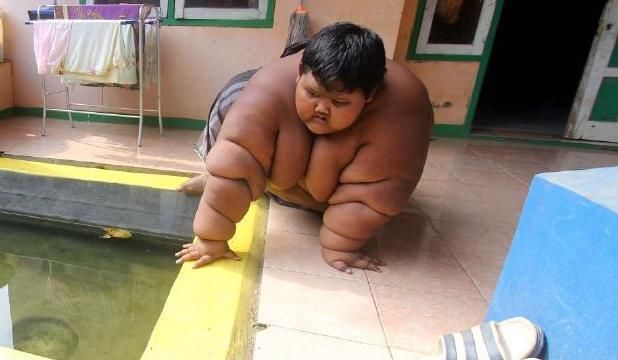 380斤！男孩儿界的吉尼斯世界纪录创造者 为减肥只有切胃