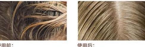 鹿晗、阿娇、张歆艺等明星御用的洗发水，狂销千万瓶的控油固发神