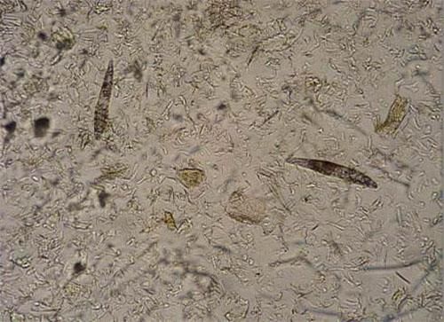 螨虫”肆虐让人顶着满脸痘痘怎么办？学会这些方法就能除螨祛痘！
