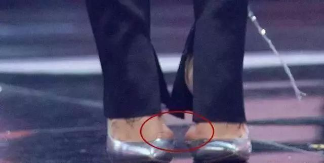 穿高跟鞋有多辛苦?冉莹颖脚被勒出印，她的脚趾变形