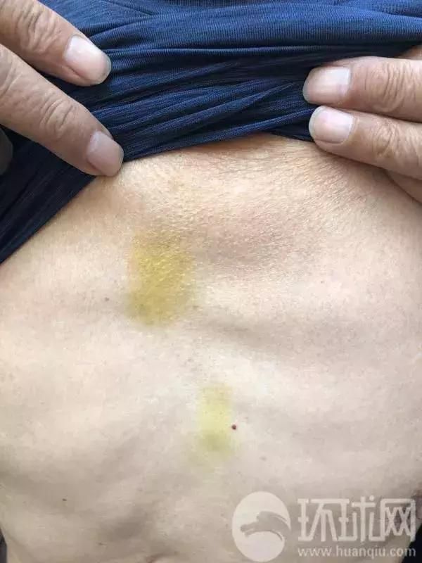 驻瑞使馆谈中国游客被扔公墓事件:当事人压力很大,网友勿落井下