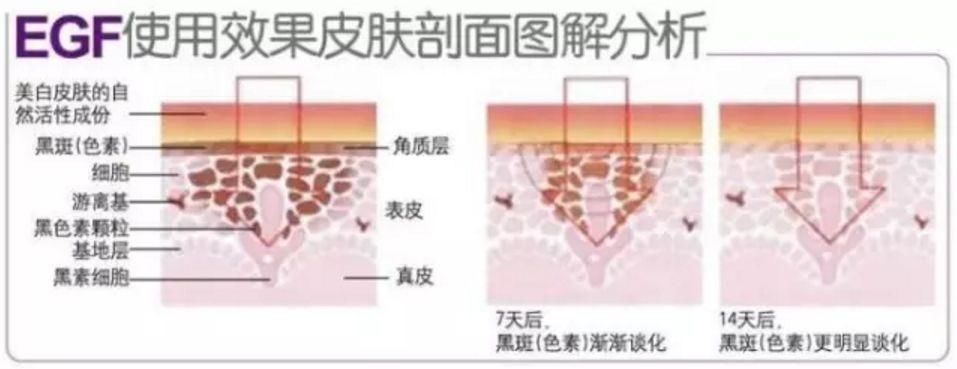 江疏影白到发光的“灯泡皮”怎么养成的?原来全靠这个神器...