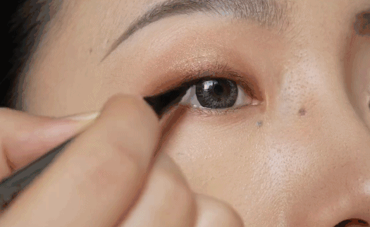 惊!戚薇开眼角了?还是无痛的