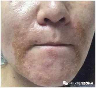 炎炎夏日，教你几招摆脱 “大油脸”！这几个控油雷区千万别踩…