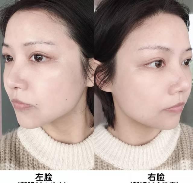  『脏东西』被口罩闷到快毁容的你，需要赶快做这两件事补救下！