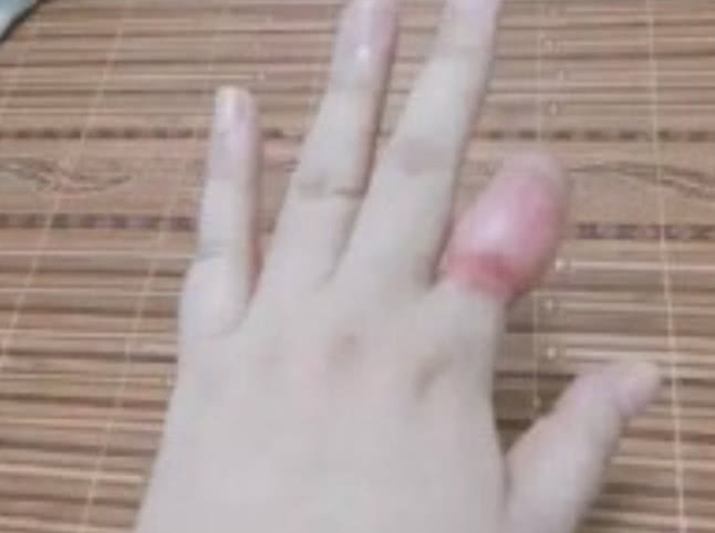 ?网友晒“掰手指”后果照，怒批薛之谦拿孩子炒作：不配当父母！