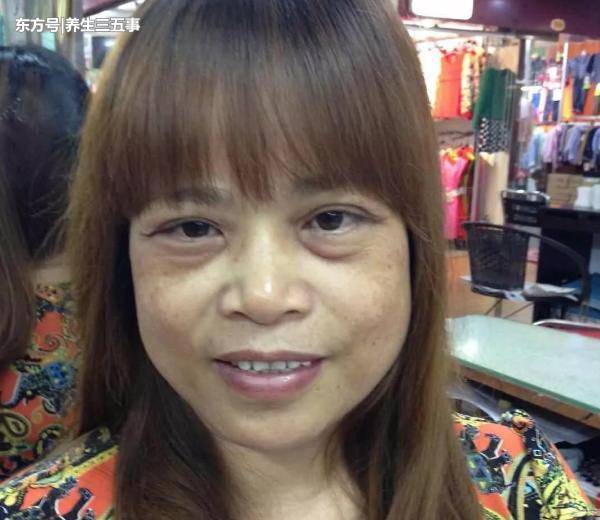 从事美容行业20年，因“堵塞型”黄褐斑愁白头，一纸良方救了她