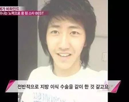 谁说整容太多脸会崩？这些明星用实力给大家辟谣！