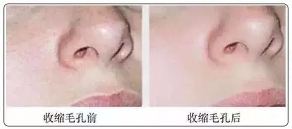 网上疯传的7条护肤谣言，是时候揭穿了！