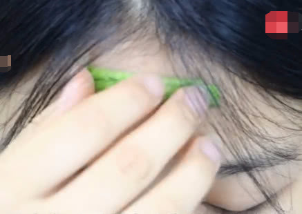 丝瓜皮别再扔掉了，一般人都不知道它的作用，我也后悔没早点知道