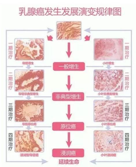 年纪轻轻就拥有飞机场?胸小是你没穿对吧