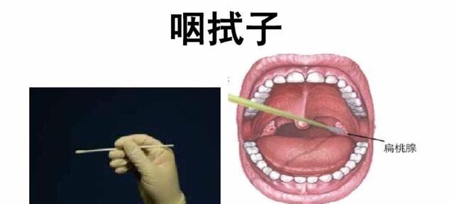基因序列■辟谣：疫情期间同房会影响新冠病毒核酸检测的结果吗