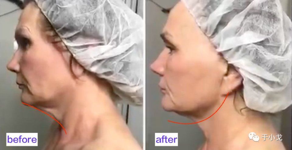 曝大S童年"黑"历史,拼命美白会有害健康么?