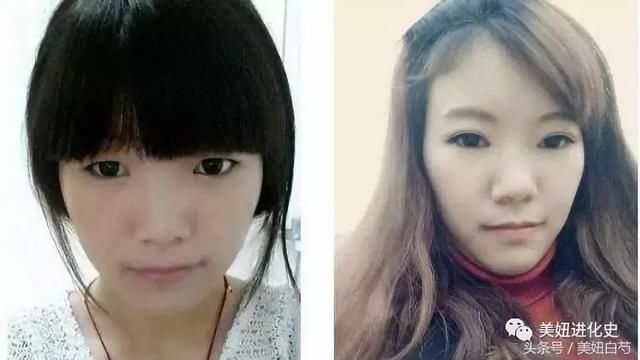 为什么她做了双眼皮却没有变美？
