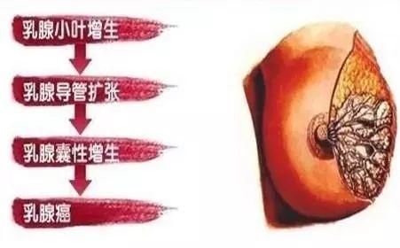 会呼吸的内衣!比裸睡还舒服，穿上降温5度，堪称移动小空调!