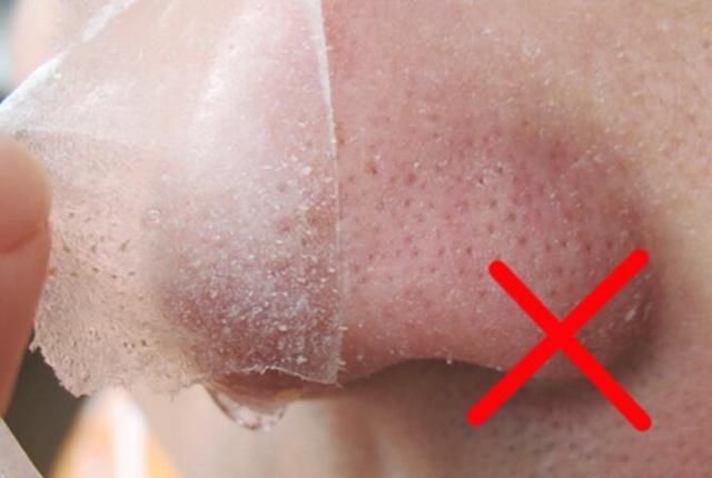 鼻子“小颗粒”挤了又长，用这3个大招，从此黑头不再“发芽”