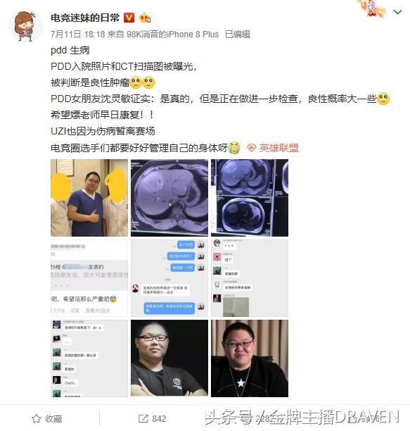 辟谣！嫖老师没有得肝癌，三天后才出诊断结果！