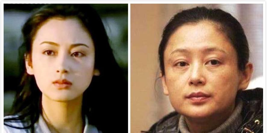  [外侧脂肪]脸上有这5个“迹象”的女人，容易显老，出现一个就要警惕
