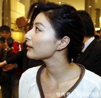 郭晶晶一改朴实风，终于穿得像名媛，网友却紧盯她胸口红斑看不停