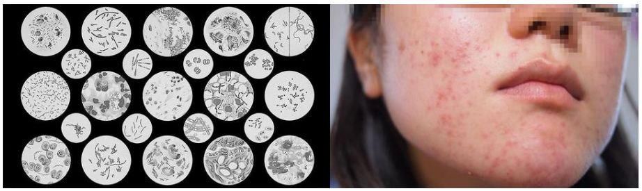 令人骄傲的“中国制造”还不多，但这中国农科院研发的抗痘神器肯