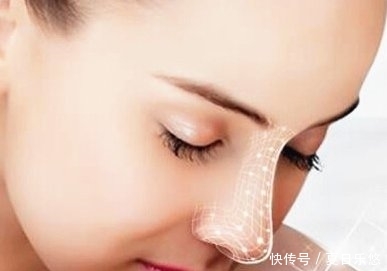  『隆鼻』达拉斯隆鼻有什么危害吗