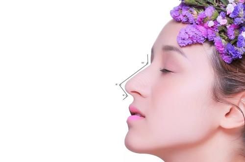  「医生的嘱咐」哪种隆鼻方式适合你？术后该如何护理？