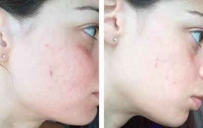 性价比逆天!大瓶好用的湿敷新宠，美白补水缩毛孔，0差评，上架就