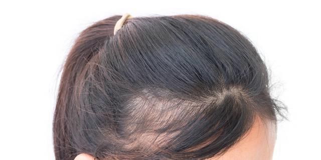  「发际线」女生变美的方法及好用护肤品推荐?