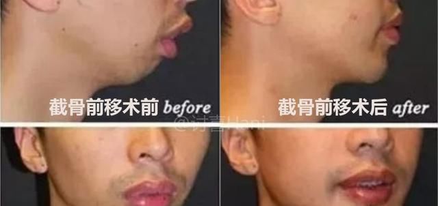  「增量与减」改变都有可能牵一发而动全身