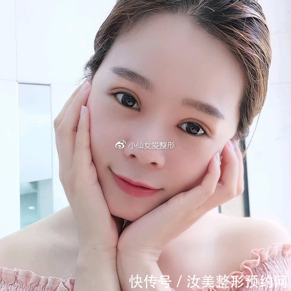 开内眼角前后对比照片，不灵不灵的大眼睛也着实的迷人