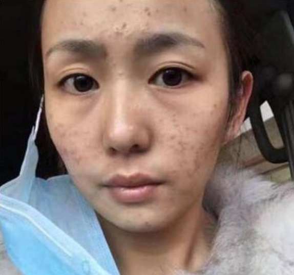 维生素e配上它，祛斑美白顶呱呱，10天脸蛋白嫩有光泽