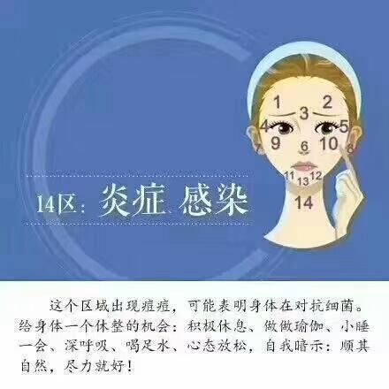 痘痘粉刺也叫痤疮，不同部位有不同原因，爱长痘痘的童鞋对号入座
