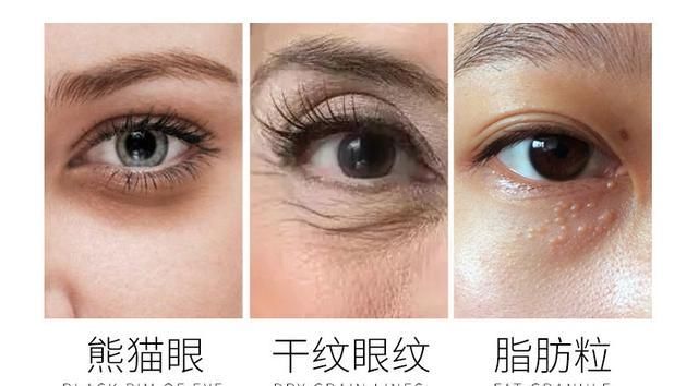  「皮肤」过了25岁,为啥要早晚都擦“眼霜”?我一直犯傻!怪不得长眼纹