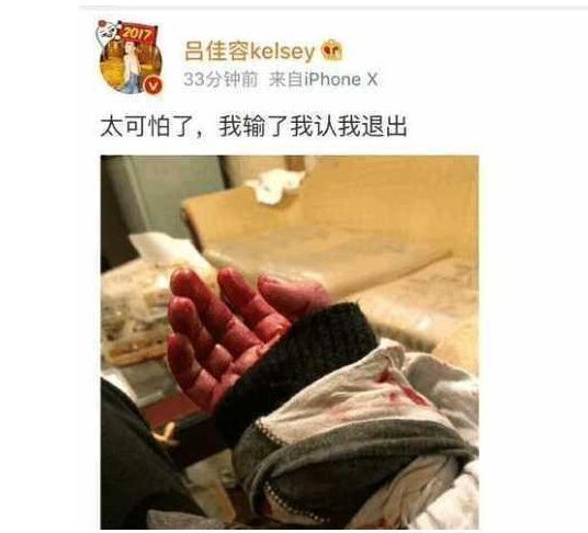 自导自演回应已婚上热搜算什么,曾曝光乔的她还深夜发割腕图呢!